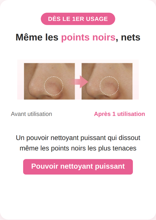 Baume nettoyant - Banila Co Clean it Zero Original